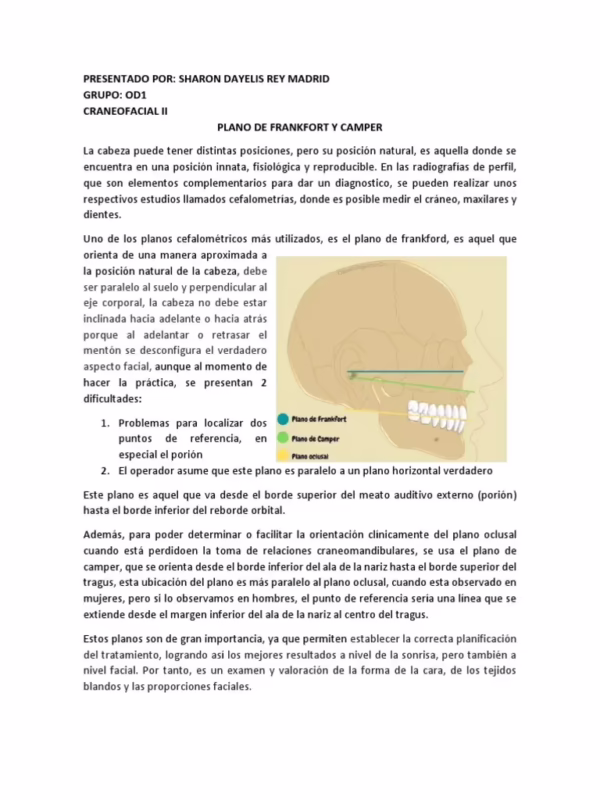 ¿Qué es un kamper?
